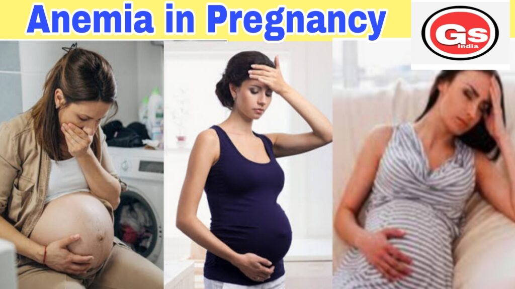 What Is Anaemia In Pregnancy Sign And Symptoms Types Of Anemia And Its Causes And Treatment Test 4730