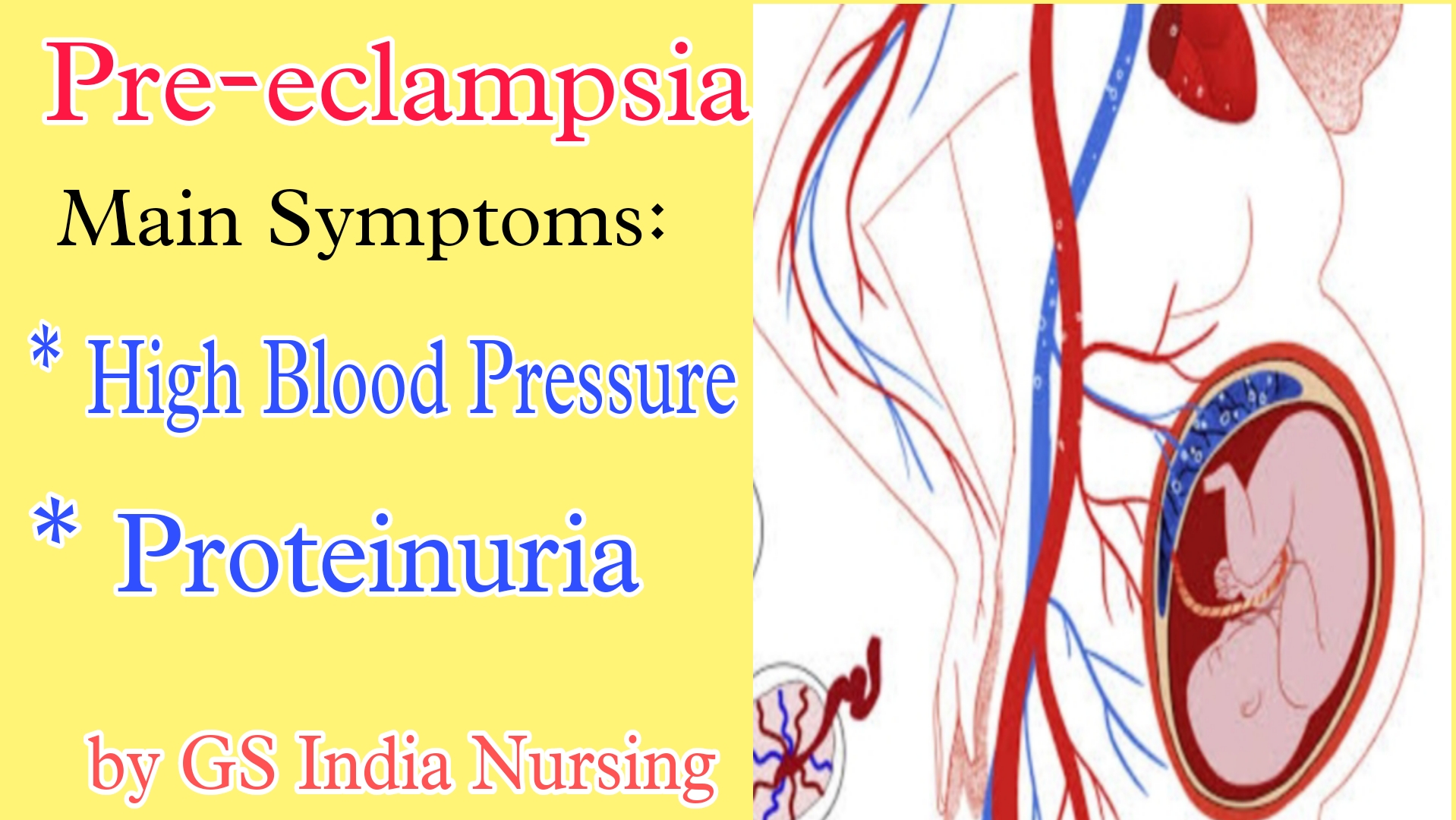 preeclampsia-may-involve-the-fetal-genes-the-pulse